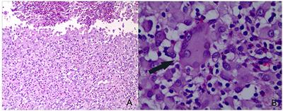 A New Rabbit-Skin Model to Evaluate Protective Efficacy of Tuberculosis Vaccines